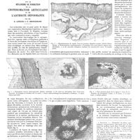 1451 - Page 1441 - Travaux originaux. Clinique chirurgicale A de Strasbourg. Recherches expérimentales sur le mécanisme de formation de la chondromatose articulaire et de l'arthrite déformante. Par MM. R. Leriche et E. Brenckmann