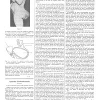 1680 - Page 1670 - Chroniques, variétés et informations. Curiosités médicales. Hernie sacrée d'un utérus gravide rétrofléchi après résection du sacrum pour amputation du rectum / Intérêts professionnels