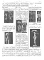 Fig. 6. Statues égyptiennes (Louvre) / Fig. 7. Apollon archaïque d'Actium (Louvre) / Fig. 8. Torse d [...]