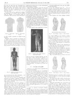 Fig. 13 Torse étroit du bas / Fig. 14. Torse étroit du haut / Fig. 15. Apollon de Piombino (Louvre). [...]