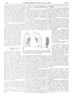 Fig. 7. Forme grave de stase veineuse. Augmentation de volume des hiles avec diminution considérable [...]