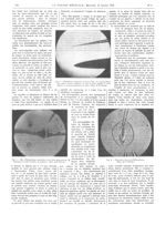 Fig. 4. Dimensions comparées au microscope, des pointes d'une fine aiguille d'acier ordinaire (en ba [...]