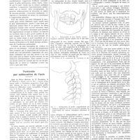 0092 - Page 92 - Petites cliniques de «La Presse médicale» N° 191. Sclérose pulmonaire diffuse avec bronchite et emphysème. Insuffisance ventriculaire droite à marche rapide. Myocardie droite. Par L. Langeron / Torticolis par subluxation de l'axis