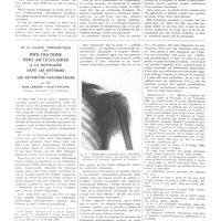 0280 - Page 280 - Travaux originaux. La forme galopante de la maladie de Basedow. Par MM. P. Carnot, H. Bénard, M. Rudolf et Paul Véran... / De la valeur thérapeutique des infiltrations péri-articulaires à la novocaïne dans les entorses et les arthrites traumatiques. Par MM. René Leriche et René Fontaine...