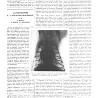 0287 - Page 287 - Travaux originaux. Maladies osseuses et troubles du métabolisme calcique. A propos de la guérison de deux cas de maladie de Paget et de Recklinghausen. Par P. Delmas-Marsalet... / L'angiographie et l'angiopneumographie. Par MM. A. Ravina, A. Sourice et L. Benzaquen