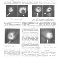 0294 - Page 294 - Mouvement médical. La transillumination du sein / Bibliographie