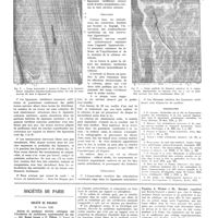 0317 - Page 317 - Travaux originaux. Travail de la clinique chirurgicale A, Strasbourg. Directeur : Professeur R. Leriche. Recherches histologiques sur l'innervation des articulations des corps vertébraux. Par MM. Adolphe Jung... et Alexandre Brunschwig... / Bibliographie / Sociétés de Paris. Société de biologie. 20 février 1932