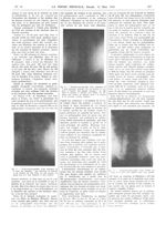 Fig. 1. Pyélo-roentgénographie d'une primipare de 6 mois / Fig. 2. Roentgéno-pyélographie d'une prim [...]