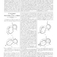 0608 - Page 604 - Travaux originaux. La vaccination antidiphtérique par l'anatoxine progrès et précisions. Par MM. G. Ramon et R. Debré / Le traitement des fractures du col du fémur. Par L. Tavernier...