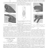 0633 - Page 629 - Travaux originaux. Travail de la clinique de M. le prof. L. Tixier. La résection du tissu cellulaire dans le traitement des panaris. Par MM. J. de Rougemont et F. Carcassonne / La sécrétion gastrique dans l'urticaire. Par Ch. Rahier...