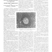 0645 - Page 641 - Travaux originaux. Le substratum anatomo-pathologique et bactériologique du rhumatisme tuberculeux. Par MM. Fernand Bezançon, Mathieu-Pierre Weil, J. Delarue et V. Oumansky