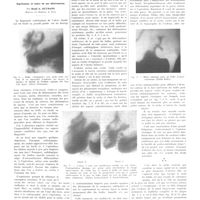 0665 - Page 661 - Travaux originaux. Clinique chirurgicale de la Salpêtrière (Professeur Gosset). Le bulbe duodénal ulcéreux. Signification et valeur de ses déformations. Par René A. Gutmann...