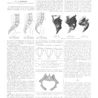 0673 - Page 669 - Travaux originaux. Le «sacrum basculé» cause des pseudo-lumbagos, pseudo-sciatiques, pseudo-rhumatismes vertébraux. Par J. Gourdon...