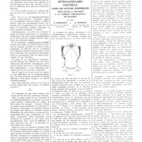0699 - Page 695 - Travaux originaux. Lymphogranulomatose maligne et tuberculose. Etude critique d'après 6 cas étudiés cliniquement et expérimentalement. Par MM. F. Bezançon, Weismann-Netter, Oumansky et Delarue / Clinique I chirurgicale. Hôpital Coltzea, Bucarest. Technique opératoire pour la thyroïdectomie intracapsulaire partielle dans les goitres endémiques telle qu'on la pratique à la clinique chirurgicale I de Bucarest. Par MM. C. Angelesco... et G. Buzoïanu...