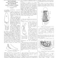 0817 - Page 813 - Travaux originaux. Le signe de la douleur plantaire pré-talonnière pour le diagnostic précoce des phlébites post-opératoires. Par M. le professeur Ducuing...