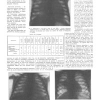 0819 - Page 815 - Travaux originaux. Sur l'application de l'antigène méthylique dans la pratique du dispensaire. Par MM. L. Sayé... et T. Seix...