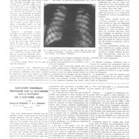 0820 - Page 816 - Travaux originaux. Sur l'application de l'antigène méthylique dans la pratique du dispensaire. Par MM. L. Sayé... et T. Seix... / Élévation thermique provoquée par la diathermie dans le traitement de l'asthme aigu. Par MM. Samuel M. Feinberg... et S. L. Osborne...