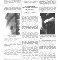 1002 - Page 990 - Travaux originaux. Travail du centre anticancéreux de la banlieue parisienne (directeur : professeur Gustave Boussy). Étude de la voie d'évacuation de la vésicule biliaire. Par Nemours-Auguste / Travail de l'institut central de radiologie de l'hôpital cantonal de Genève (Directeur : R. Gilbert, chargé de cours). Un procédé rapide d'exploration radiologique de l'appendice. Par MM. S. Kadrnka et R. Sarasin