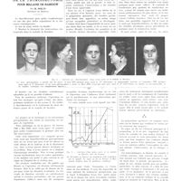 1113 - Page 1101 - Travaux originaux. Travail de la clinique thérapeutique chirurgicale de la faculté de Paris (Service du professeur Pierre Duval). Les résultats de la thyroïdectomie pour maladie de Basedow. Par H. Welti...
