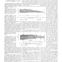 1125 - Page 1113 - Travaux originaux. L'épreuve d'hyperpnée provoquée en espace clos. Son application chez le normal. Par MM. R. Goiffon, R. Parent et J. Waltz