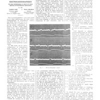1233 - Page 1221 - Travaux originaux. La prépondérance ventriculaire gauche électrocardiographique. Sa valeur séméiologique et celle de la notion générale de prépondérance ventriculaire. Par MM. Camille Lian... et Victor Golblin...