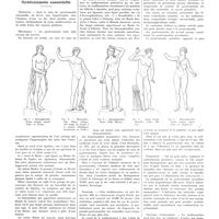 1355 - Page 1343 - Chroniques, variétés et informations. Gynécomastie essentielle