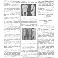 1356 - Page 1344 - Chroniques, variétés et informations. Gynécomastie essentielle / Georges-Simon Sérullas (1774-1832). Inventeur de l'iodoforme [Nécrologie]