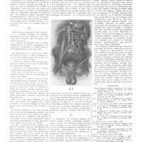 1426 - Page 1414 - Travaux originaux. Une forme clinique exceptionnelle du cancer du testicule séminome avec syndrome abdominal suraigu. Par MM. A. Gosset, G. Loewy et P. Funck-Brentano / Bibliographie