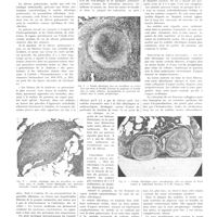 1507 - Page 1495 - Travaux originaux. Le nodule silicotique pulmonaire. Par A. Policard