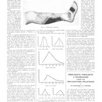 1516 - Page 1504 - Travaux originaux. Un cas de panvascularite aigüe des membres inférieurs avec troubles du métabolisme du calcium. Par MM. A. Bréchot et J. Pergola / Péricardite purulente à pneumocoques guérie par péricardotomie épigastrique. Par Ed. Benhamou et P. Goinard