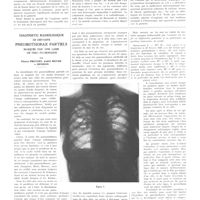 1761 - Page 1745 - Travaux originaux. Sur une forme particulière d'angiome caverneux du rectum. L'angiome cutanéo-muqueux ou génito-périnéo-rectal. Par R. Bensaude et A. Bensaude / Diagnostic radiologique de certains pneumothorax partiels masqués par une lame de tissu pulmonaire. Par Pierre Pruvost, André Meyer et Henrion