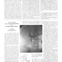 1936 - Page 1920 - Travaux originaux. La pénétration et la propagation de la tuberculose par les voies lymphatiques cervicales. Étude expérimentale. Par MM. Émile Sergent et I. Gaspar / Sur les données de la cholécystostomie dans les ictères infectieux. Par MM. Léon Bérard et Pierre Mallet-Guy