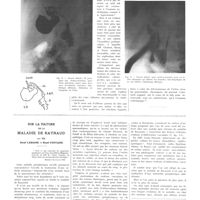 1937 - Page 1921 - Travaux originaux. Sur les données de la cholécystostomie dans les ictères infectieux. Par MM. Léon Bérard et Pierre Mallet-Guy / Sur la nature de la maladie de Raynaud. Par MM. René Leriche et René Fontaine