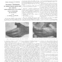1957 - Page 1941 - Travaux originaux. Clinique chirurgicale A de Strasbourg. Troubles trophiques et nécrotiques singuliers des doigts comme premiers signes d'une leucémie. Faux syndrome de Raynaud. Par MM. R. Leriche et R. Fontaine