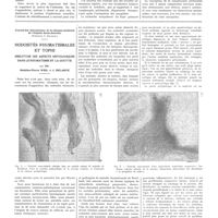 1985 - Page 1969 - Travaux originaux. La lymphangite péritonéale. Par B.-O. Pribram... / Travail des laboratoires de la clinique médicale de l'hôpital Saint-Antoine. (Professeur F. Bezançon). Nodosités rhumatismales et tophi. Similitude des aspects histologiques dans le rhumatisme et la goutte. Par MM. Mathieu-Pierre Weil et J. Delarue