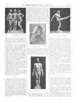 Fig. 4. Tres in una. Groupe par Paul Richer, au Petit Palais / Fig. 5. Le coup de pied. Statuette at [...]