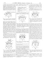 Fig. 1. D..., femme, 39 ans. Douleur lombo-abdominale bilatérale. L'apophyse transverse LV à droite  [...]