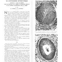 0141 - Page 137 - Travaux originaux. De l'ostéogenèse hétérotopique obtenue à l'aide de greffes dans les muscles d'un lambeau de muqueuse vésicale ou de greffes d'aponévrose dans la vessie. Par MM. R. Leriche et E. Lucinesco