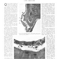 0144 - Page 140 - Travaux originaux. Quelques expériences sur l'ossification hétérotopique dans la rate. Par MM. A. Jung et Sureyya Cemil