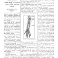 0325 - Page 321 - Travaux originaux. Quelques remarques sur les artérites ectasiantes de l'endocardite maligne lente. Par MM. Noël Fiessinger, A. Ravina et R. Messimy