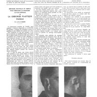 0329 - Page 325 - Travaux originaux. Quelques précisions sur les éléments filtrables du bacille de Koch. Par MM. J. Valtis et F. Van Deinse / Méthode nouvelle et simple pour résoudre le problème le plus difficile de la chirurgie plastique faciale. Par J.-F.-S. Esser