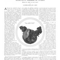 0381 - Page 377 - Travaux originaux. Infarctus et gangrène de l'utérus (Nécrose dite «alcaline» par eau de savon). Par H. Mondor, Marthe Lamy et Leroy