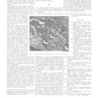 0388 - Page 384 - Travaux originaux. Le réticulo-sarcome de la rate. Par MM. Henri Stevenin, André Bergeret, Guy Albot et Jean Lelourdy / Bibliographie