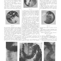 0398 - Page 394 - Travaux originaux. Sur l'étude radiologique de la muqueuse du gros intestin. Par MM. D. Branisteanu et C. Moisuc / Bibliographie