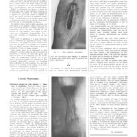 0404 - Page 400 - Travaux originaux. Métastase strepto-bacillaire profonde dans un cas de chancre mou phagédénique. Par MM. A. Banciu..., A. Maisler... et C. Popesco... / Livres nouveaux. Radiologie clinique du tube digestif. I. : Estomac et duodénum. Deuxième édition entièrement nouvelle, par Pierre Duval, J.-Ch. Roux, et Henri Béclère... [Ch. Lenormant]