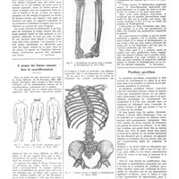 0504 - Page 500 - Notes de médecine pratique. Publiées par les soins de A. Ravina. Les accidents dus à l'électricité et les moyens de secours actuels / A propos des lésions osseuses dans la neurofibromatose / Ptyalisme gravidique