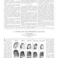 0556 - Page 552 - Travaux originaux. Les sels d'or dans le traitement de la tuberculose pulmonaire «confirmée» de l'adulte. Par MM. Pierre-Bourgeois, H. Thiel et J. Levernieux / La pathologie des empreintes digitales. Par Leonido Ribeiro...
