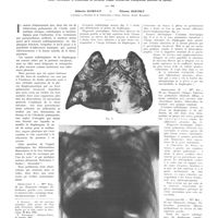 0569 - Page 565 - Travaux originaux. Sur la fausse interprétation de certains aspects radiologiques au cours de la tuberculose pulmonaire. Étude radiologique et anatomique de certaines images simulatrices d'adhérences pleurales (8 figures). Par MM. Gilberto Scorpati... et Étienne Berthet...