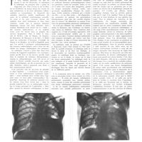 0786 - Page 782 - Travaux originaux. Grandeur et misère de la radiologie pulmonaire. Par MM. M. Chiray, R. Benda et H. Mollard