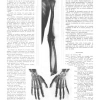 0792 - Page 788 - Travaux originaux. Progeria. Étude des lésions du système osseux. Par René Broc, Marcelle Nicolle et A. Jaubert de Beaujeu... / Bibliographie